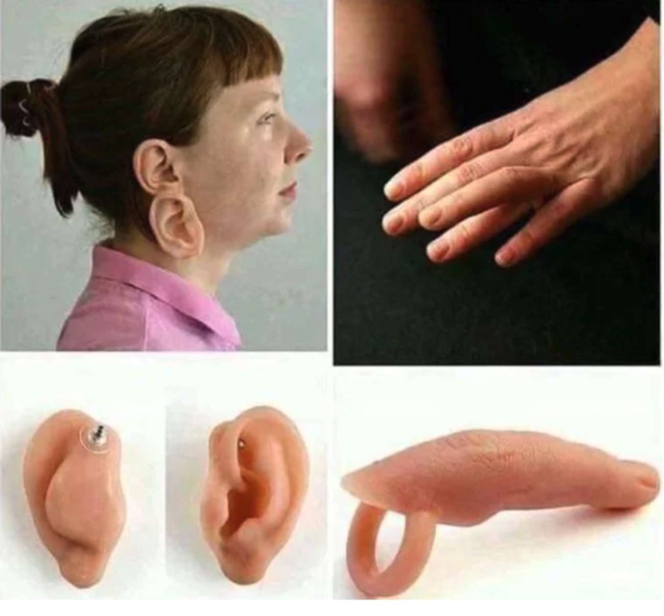 Redundant Jewelry